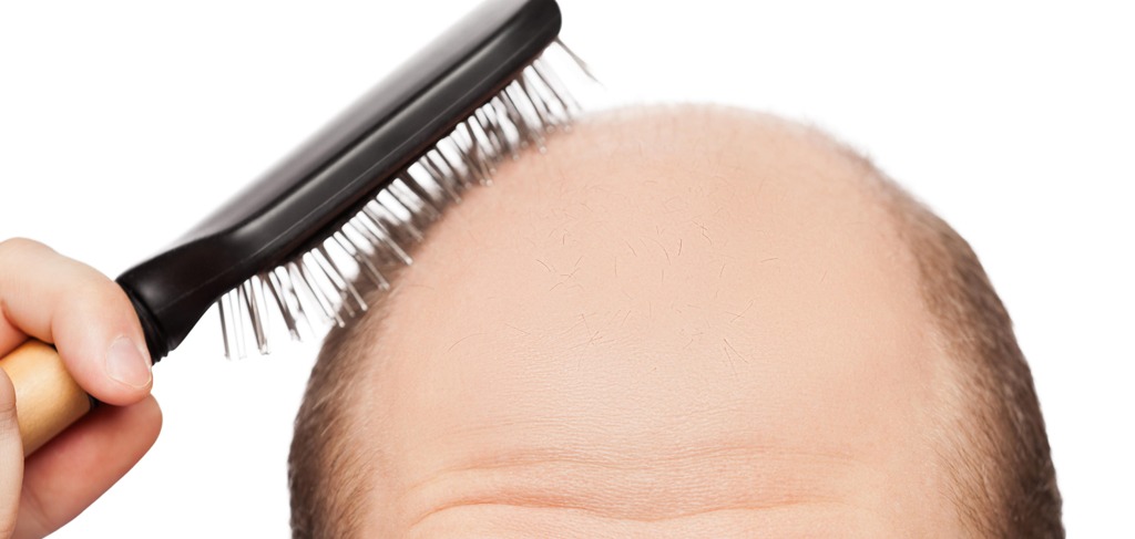 hair loss