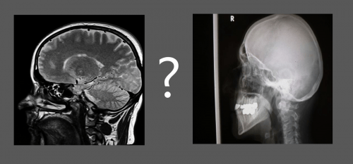 Neuro vs ortho picture
