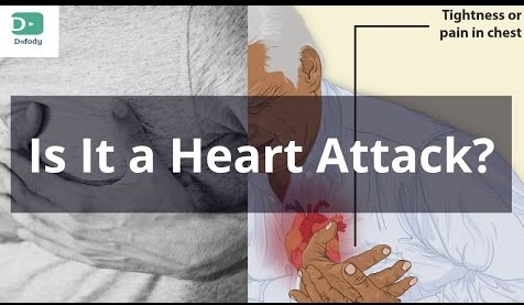 heart attack